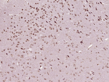 SFRS8 Rabbit Polyclonal Antibody