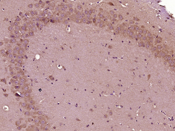 SGCE Rabbit Polyclonal Antibody