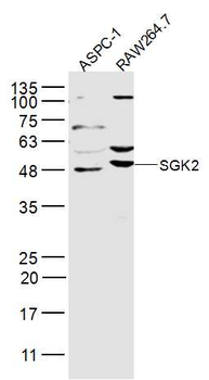 SGK2 Rabbit Polyclonal Antibody