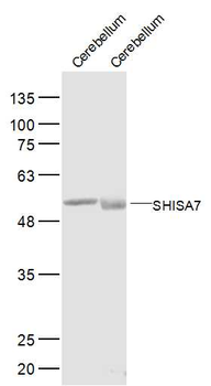 SHISA7 Rabbit Polyclonal Antibody