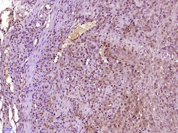 SHOX2 Rabbit Polyclonal Antibody