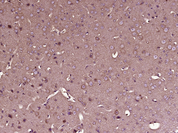 SIAH3 Rabbit Polyclonal Antibody