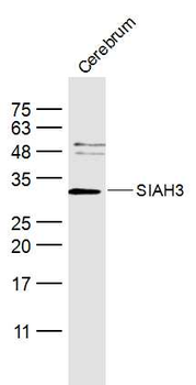 SIAH3 Rabbit Polyclonal Antibody