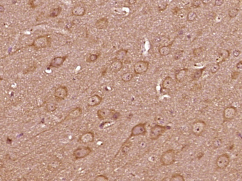 SIPA1L1 Rabbit Polyclonal Antibody