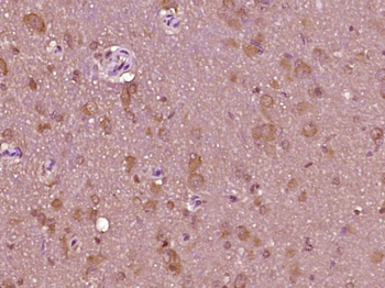 SIPA1L1 Rabbit Polyclonal Antibody