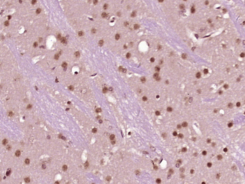 SKOR1 Rabbit Polyclonal Antibody