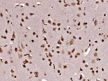 SKOR2 Rabbit Polyclonal Antibody
