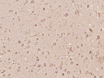 SLAIN2 Rabbit Polyclonal Antibody