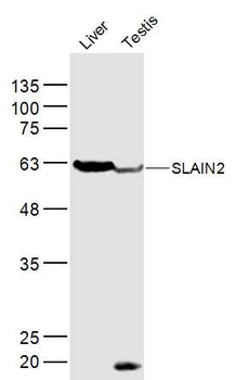 SLAIN2 Rabbit Polyclonal Antibody
