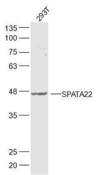 SPATA22 Rabbit Polyclonal Antibody
