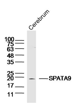 SPATA9 Rabbit Polyclonal Antibody