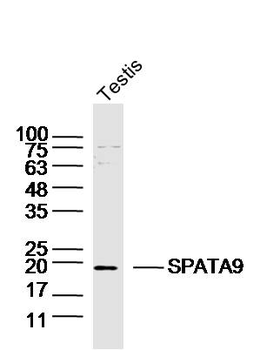 SPATA9 Rabbit Polyclonal Antibody