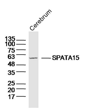 SPATA15/SPATC1 Rabbit Polyclonal Antibody