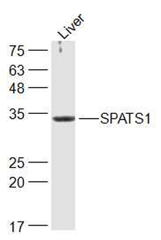 SPATS1 Rabbit Polyclonal Antibody