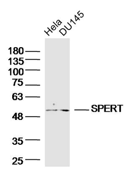 SPERT Rabbit Polyclonal Antibody