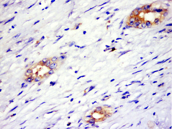 SPESP1 Rabbit Polyclonal Antibody