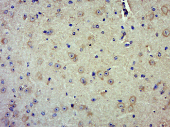 SPPase1 Rabbit Polyclonal Antibody