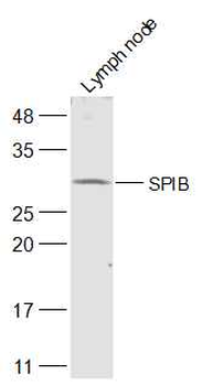SPIB Rabbit Polyclonal Antibody