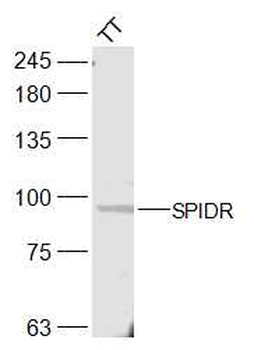 SPIDR Rabbit Polyclonal Antibody