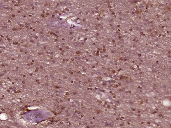 SPIN2B Rabbit Polyclonal Antibody