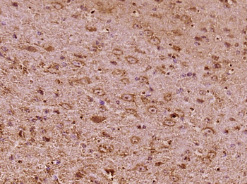 SPINK6 Rabbit Polyclonal Antibody