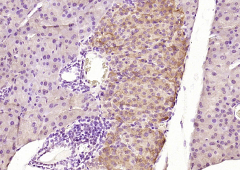 SPRED2 Rabbit Polyclonal Antibody