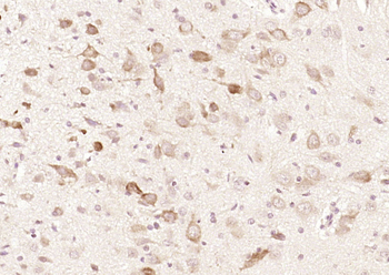 SPRED2 Rabbit Polyclonal Antibody