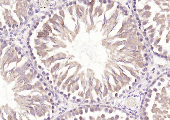 SPRED2 Rabbit Polyclonal Antibody