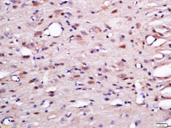 SRGAP1 Rabbit Polyclonal Antibody