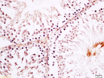 SRGAP1 Rabbit Polyclonal Antibody