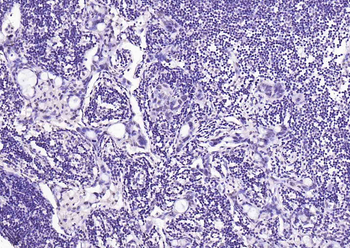 SOX9 Rabbit Polyclonal Antibody