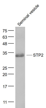 STP2 Rabbit Polyclonal Antibody