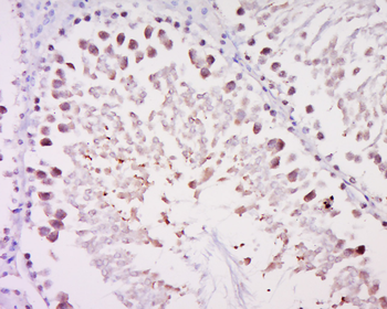 Topoisomerase III Rabbit Polyclonal Antibody