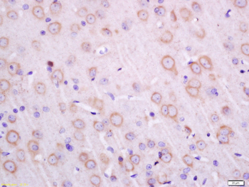Transmembrane protein 30A Rabbit Polyclonal Antibody