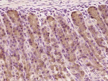 TOR3A/ADIR2 Rabbit Polyclonal Antibody