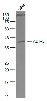 TOR3A/ADIR2 Rabbit Polyclonal Antibody