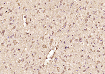 TRAX Rabbit Polyclonal Antibody