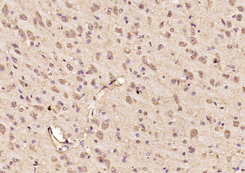 TRBP Rabbit Polyclonal Antibody