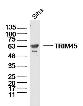 TRIM45 Rabbit Polyclonal Antibody