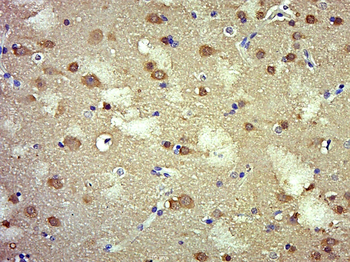 TRIM52 Rabbit Polyclonal Antibody