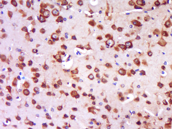 TRIT1 Rabbit Polyclonal Antibody