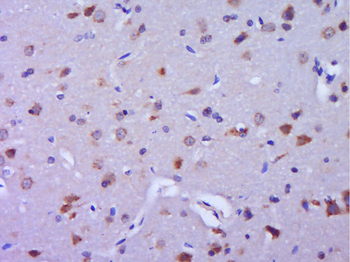 TRIM9 Rabbit Polyclonal Antibody