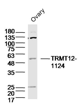 TRMT12 Rabbit Polyclonal Antibody