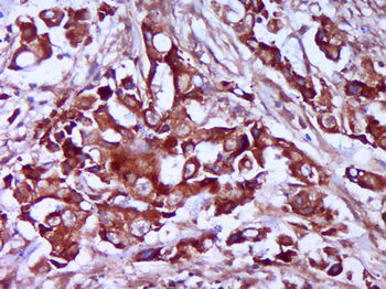 TRMT61B Rabbit Polyclonal Antibody