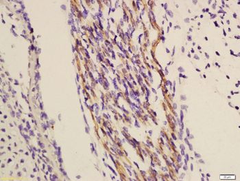 TRIOBP Rabbit Polyclonal Antibody