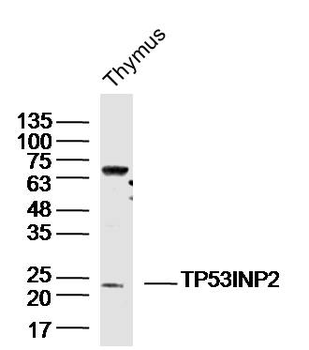 TP53INP2 Rabbit Polyclonal Antibody