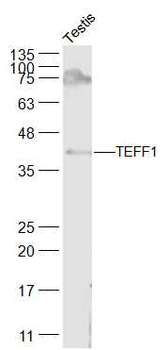 TMEFF1 Rabbit Polyclonal Antibody