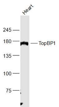 TopBP1 Rabbit Polyclonal Antibody