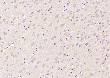 Topoisomerase II beta Rabbit Polyclonal Antibody