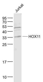 TCL3/HOX11 Rabbit Polyclonal Antibody
